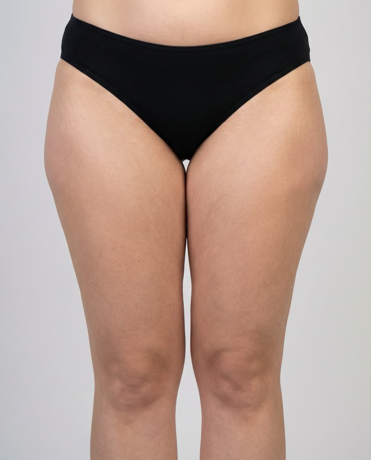 Before Tumescent Liposuction on inner thighs & outer thighs — Female patient, age 29