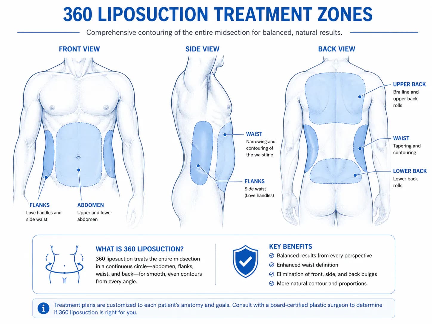 360 lipo treatment zones covering torso, flanks, and back for full circumferential contouring