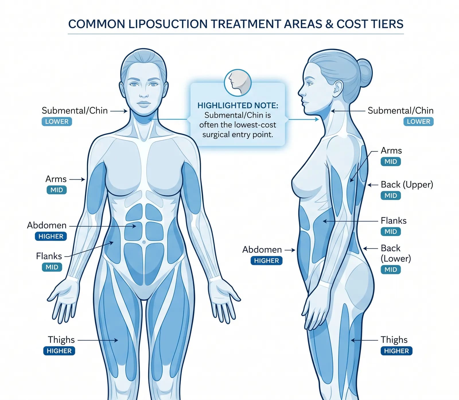 most affordable liposuction body areas: annotated body map with lowest-cost zones for budget planning