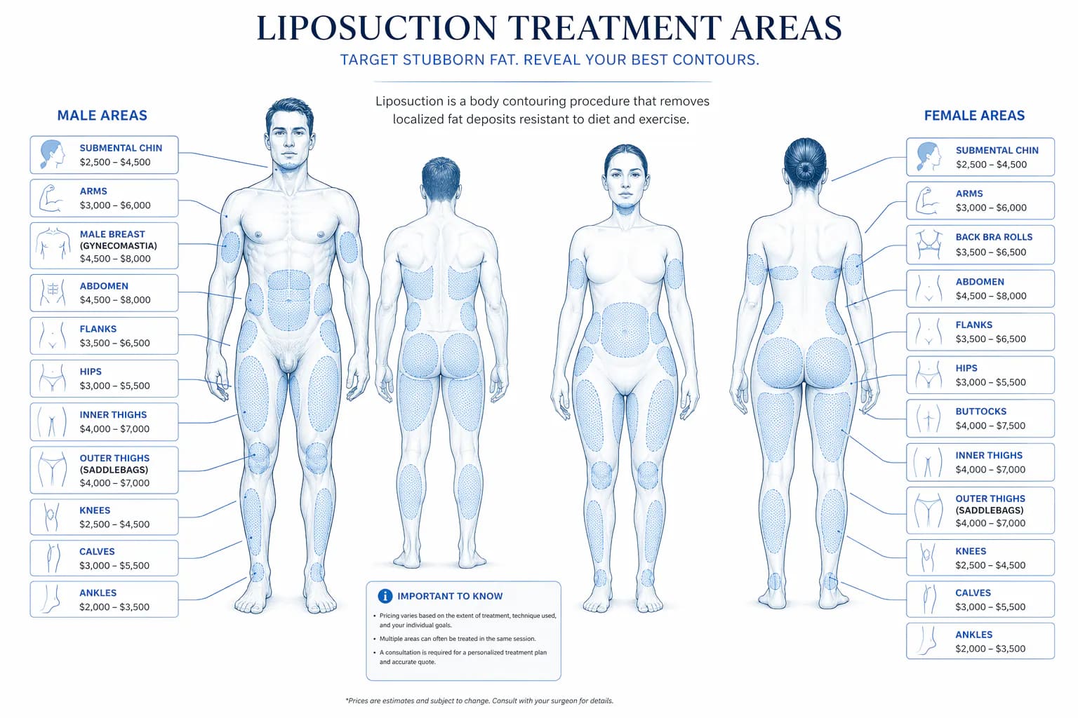 liposuction cost by body area: annotated body map with 2026 national price ranges per zone