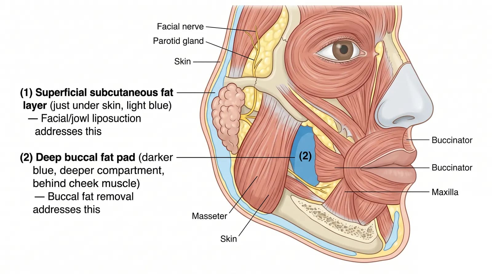 facial fat types: superficial subcutaneous fat vs deep buccal fat pad — different procedures required