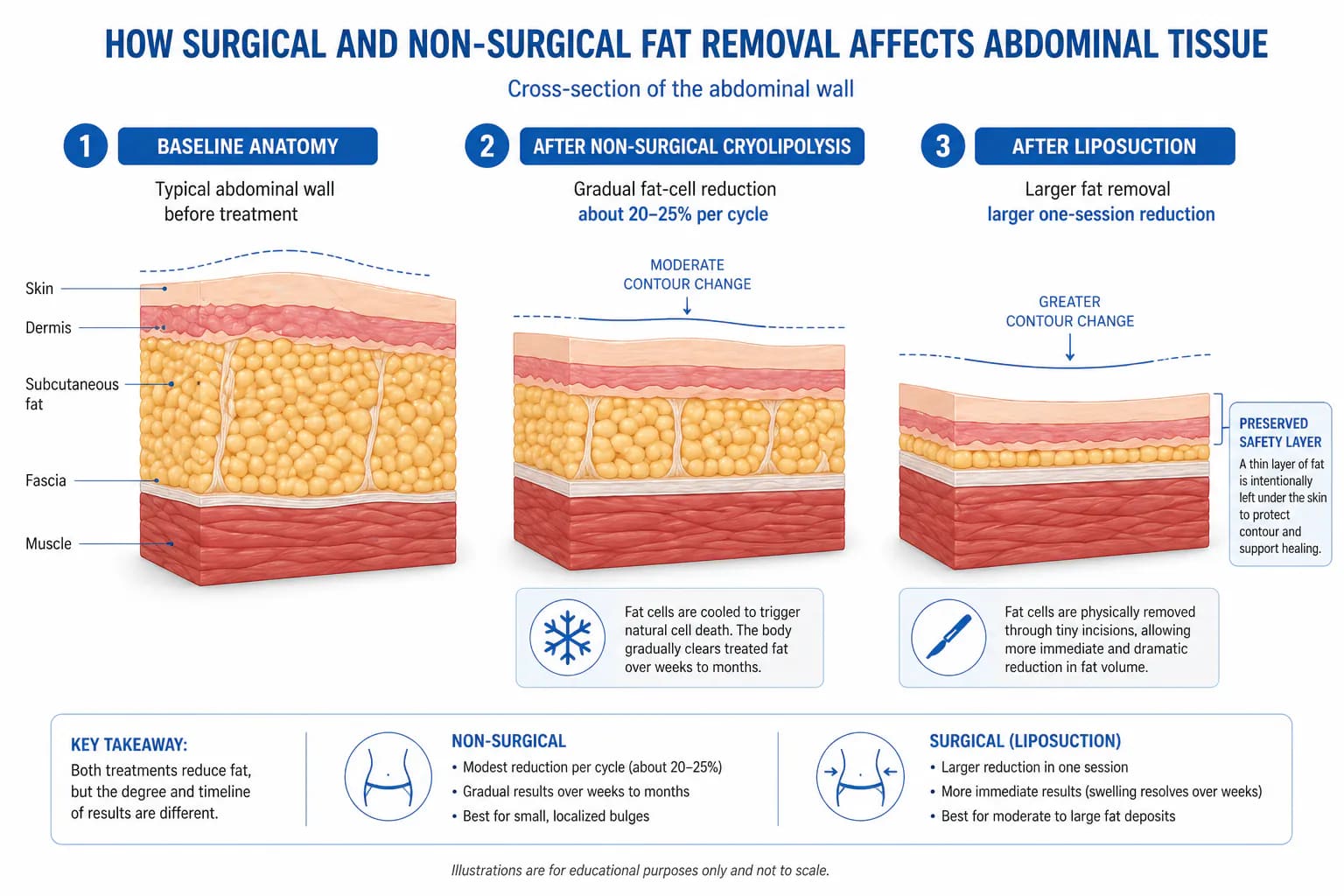 fat reduction efficacy by treatment layer: how deep each technology reaches and what results are realistic
