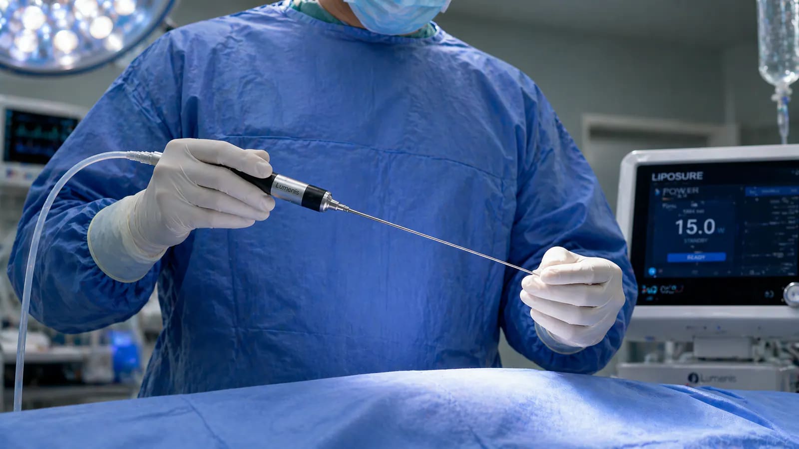 laser liposuction (SmartLipo) procedure overview: cannula placement and heat energy targeting fat