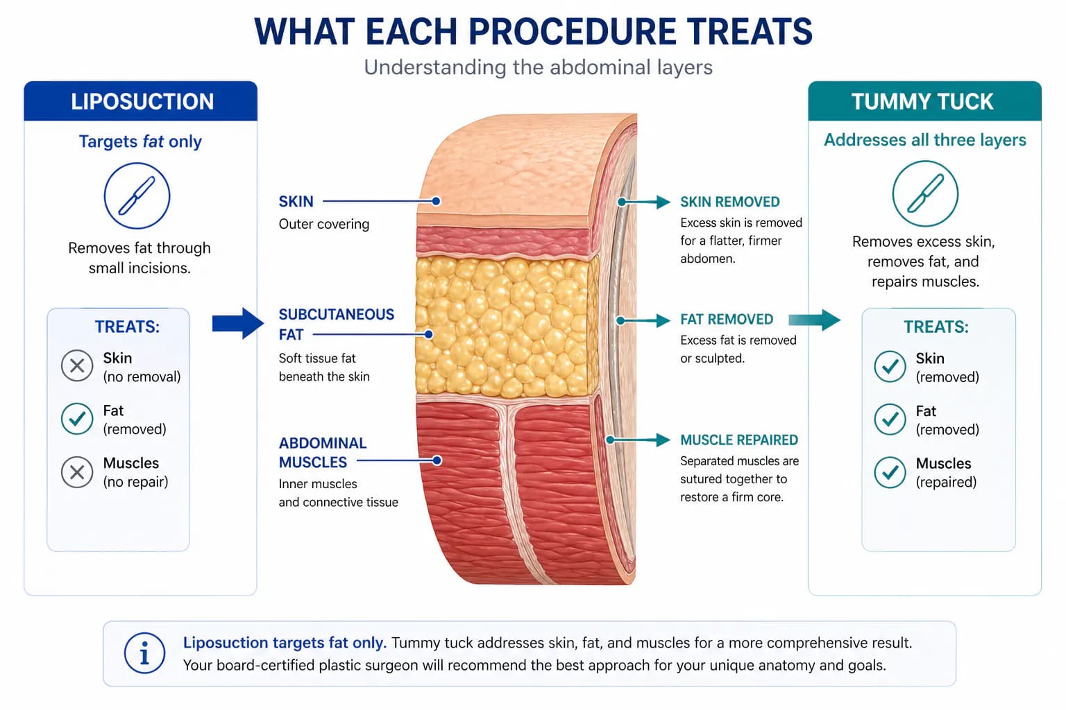 liposuction vs tummy tuck anatomy: what each procedure addresses in the abdominal and skin layers