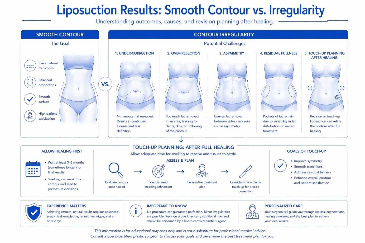liposuction contour irregularity requiring revision: uneven fat removal and correction approach