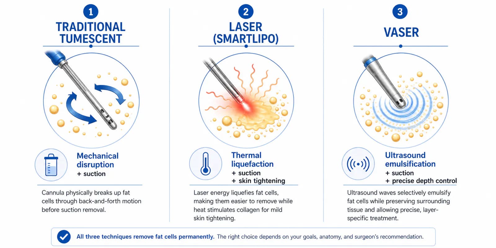 liposuction technique comparison: traditional tumescent, VASER ultrasound, and laser-assisted side by side