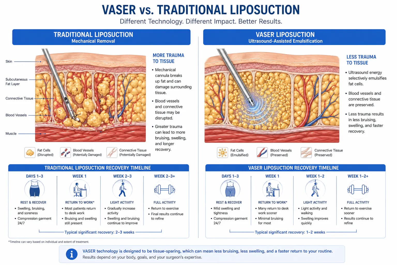 VASER vs traditional liposuction comparison: fat emulsification, precision, bruising, and recovery differences